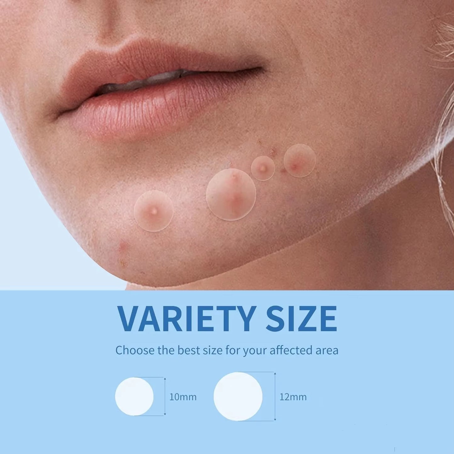 360Pcs Face Acne Patch Invisible Skin Care Pimple Acne Patches Anti-Inflammatory Healing Absorbing Spot Sticker Covering Acne